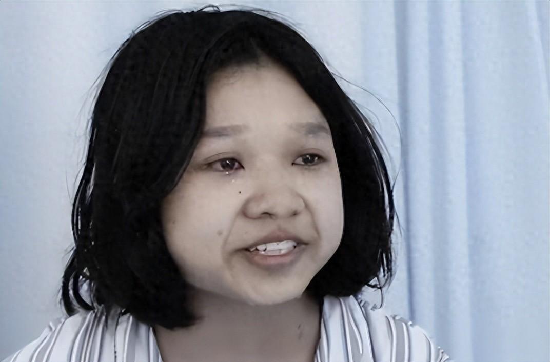 生命的奇迹：22岁女孩战胜千颗肿瘤的感人故事